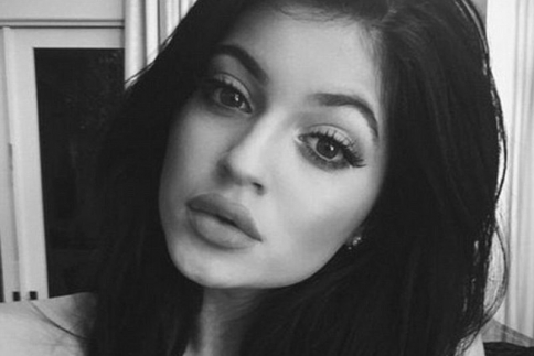 Kylie Jenner δεν πείθεις κανέναν! Τι λέει για τα φουσκωμένα χείλη 
