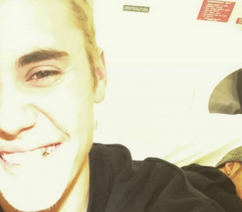 O Justin Bieber έβαλε χρυσό δόντι! Ποιοι άλλοι celebrities το τόλμησαν; 