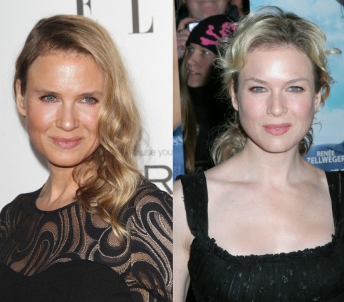 Ποιο νυστέρι; Η Renee Zellweger διαψεύδει τους πάντες!