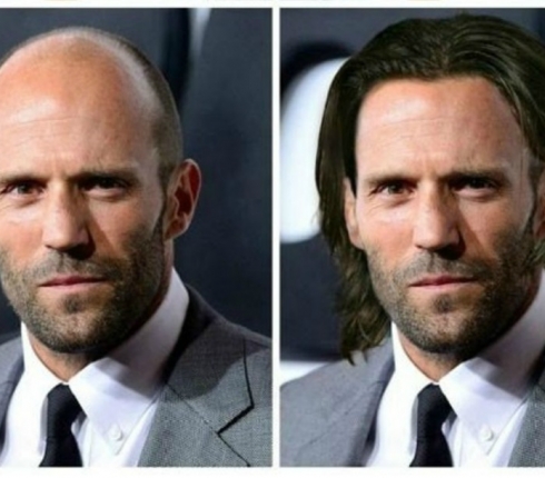 Πώς θα ήταν οι καραφλοί celebrity αν είχαν μαλλιά;