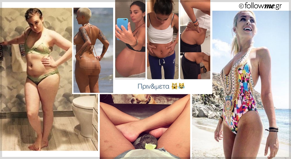 Διάσημες χωρίς photoshop: Δείξε τις ατέλειές σου όπως η Ολυμπία Χοψονίδου Διάσημες χωρίς photoshop: Δείξε τις ατέλειές σου όπως η Ολυμπία Χοψονίδου