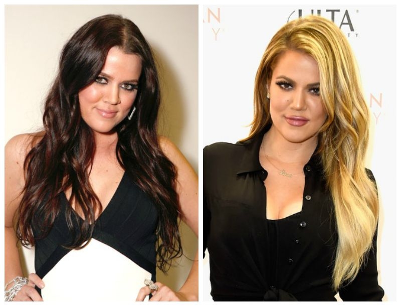 Khloe Kardashian : Το πριν και μετά τις πλαστικές Khloe Kardashian : Το πριν και μετά τις πλαστικές