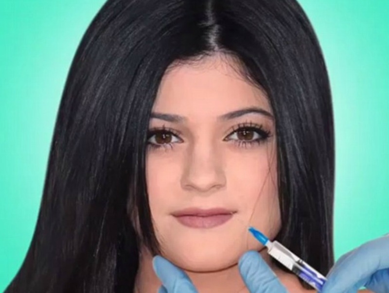 Ολική μεταμόρφωση! Πώς ήταν οι Kardashians πριν τις πλαστικές Ολική μεταμόρφωση! Πώς ήταν οι Kardashians πριν τις πλαστικές