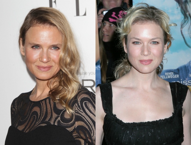 Ποιο νυστέρι; Η Renee Zellweger διαψεύδει τους πάντες! Ποιο νυστέρι; Η Renee Zellweger διαψεύδει τους πάντες!