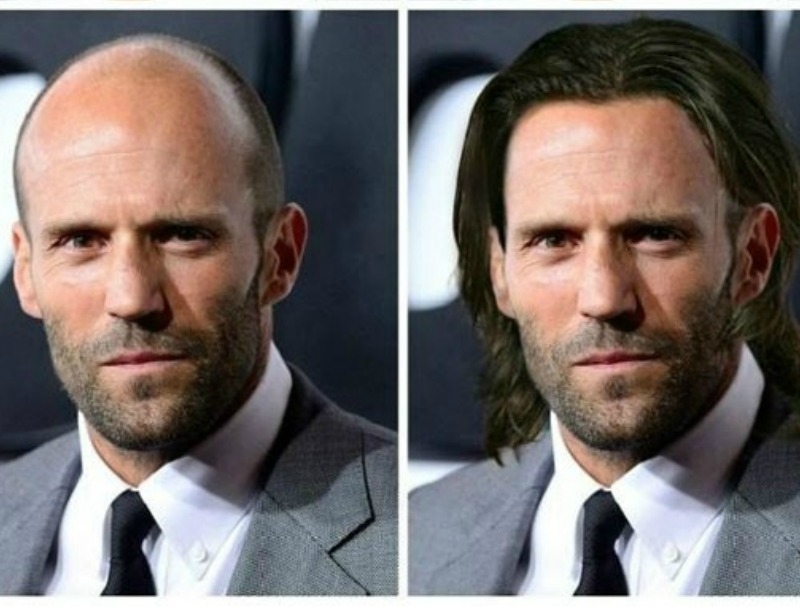 Πώς θα ήταν οι καραφλοί celebrity αν είχαν μαλλιά; Πώς θα ήταν οι καραφλοί celebrity αν είχαν μαλλιά;